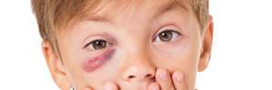 eye injury3x1